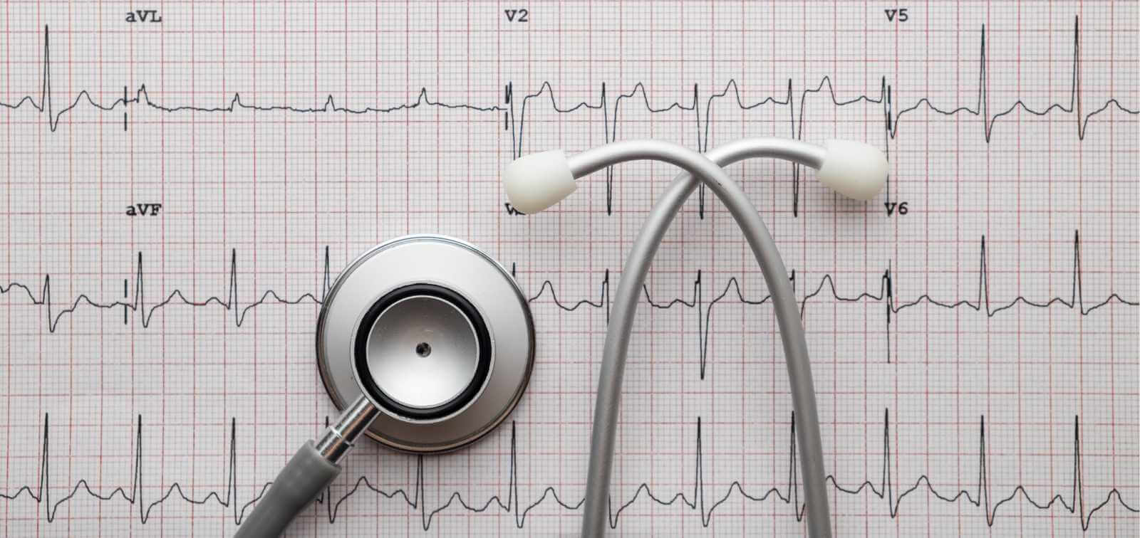 ECG signal classification
